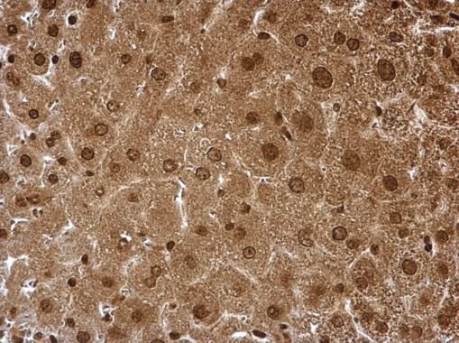 PSMA6 Rabbit Polyclonal Antibody
