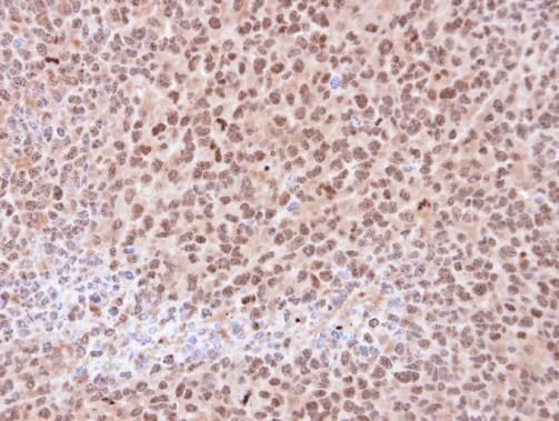 PSMA6 Rabbit Polyclonal Antibody