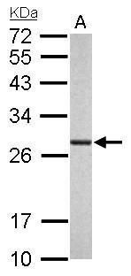 PSMA6 Rabbit Polyclonal Antibody