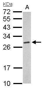 PSMA6 Rabbit Polyclonal Antibody