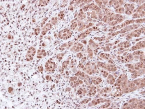 PSMA7 Rabbit Polyclonal Antibody