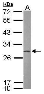 PSMA7 Rabbit Polyclonal Antibody