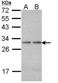 PSMA7 Rabbit Polyclonal Antibody