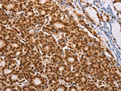 PSMD3 Antibody