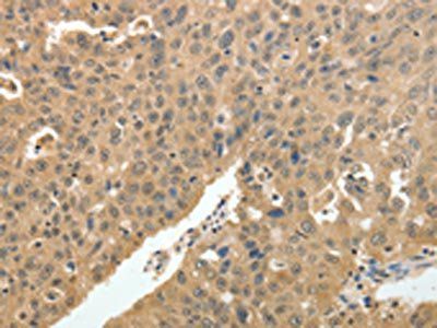 PSMD3 Antibody