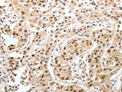 PSMD3 Antibody