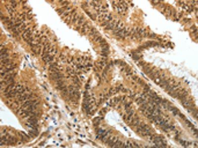PSMD3 Antibody