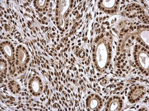 PSME3 Rabbit Polyclonal Antibody