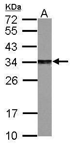 PSME3 Rabbit Polyclonal Antibody