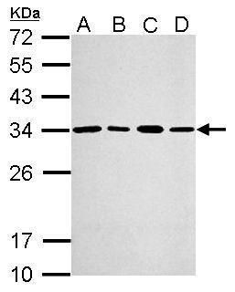 PSME3 Rabbit Polyclonal Antibody