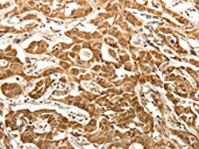 PTCH1 Antibody