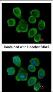 PTGFRN Rabbit Polyclonal Antibody