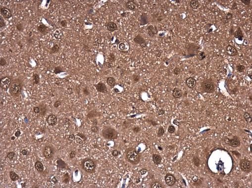 PTGFRN Rabbit Polyclonal Antibody