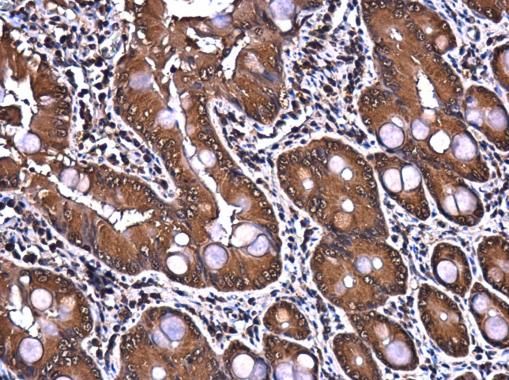 PTGFRN Rabbit Polyclonal Antibody