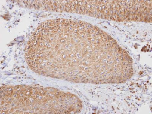 PTGFRN Rabbit Polyclonal Antibody