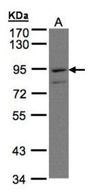 PTGFRN Rabbit Polyclonal Antibody