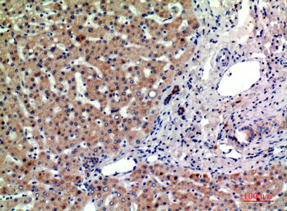 PTGFRN Antibody