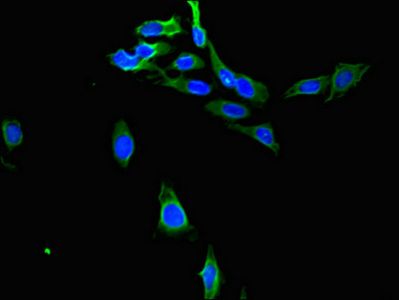 PTGR1 Antibody
