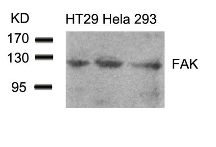 PTK2 Antibody