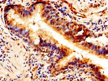 PTN Antibody