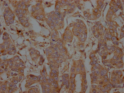 PTPN1 Antibody