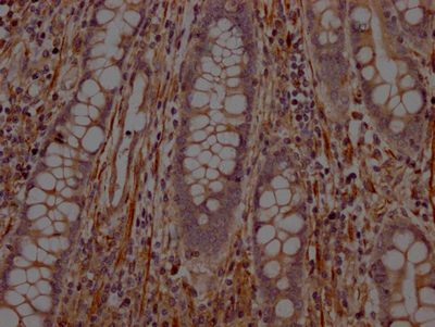 PTPN1 Antibody