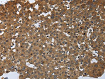 PTPRM Antibody
