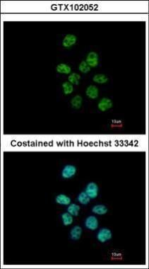 PUF60 Rabbit Polyclonal Antibody