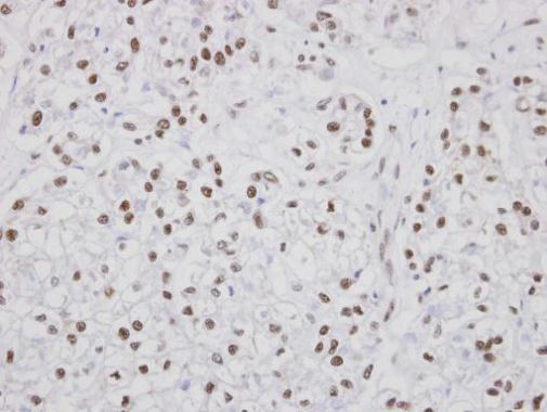 PUF60 Rabbit Polyclonal Antibody