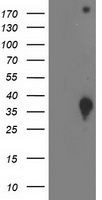 PUS7 Antibody