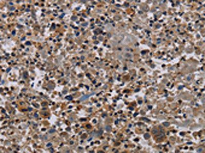 NECTIN4 Antibody