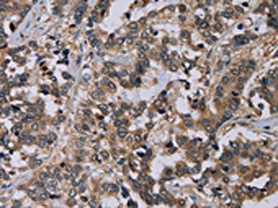 NECTIN4 Antibody