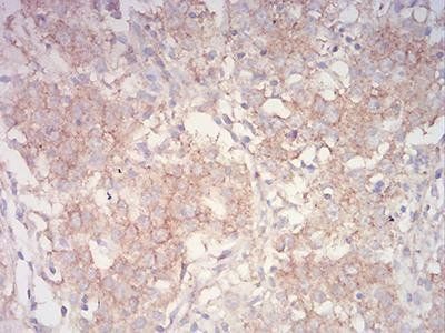 PYCARD Antibody