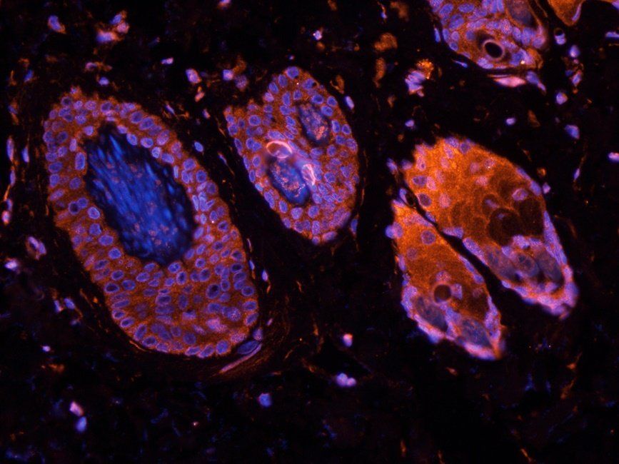 PYCR1 Rabbit Polyclonal Antibody