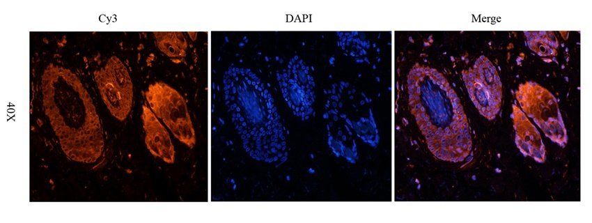 PYCR1 Rabbit Polyclonal Antibody