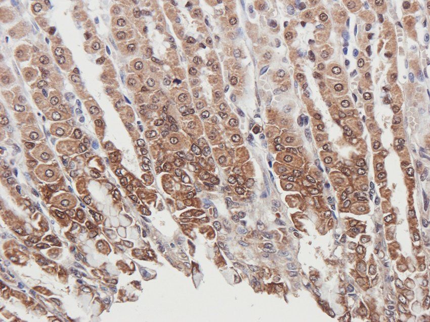 PYCR1 Rabbit Polyclonal Antibody