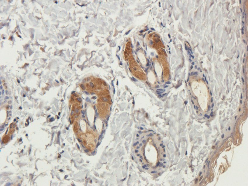 PYCR1 Rabbit Polyclonal Antibody