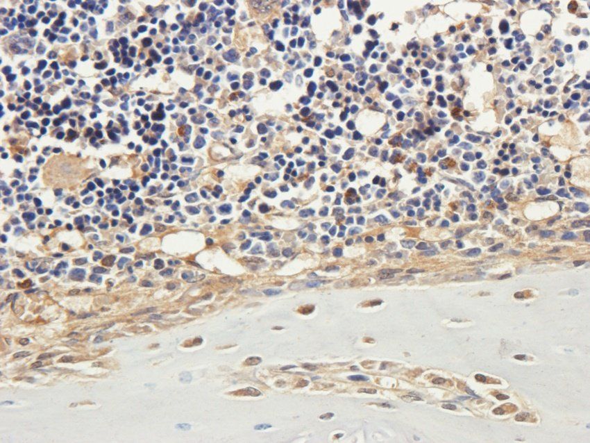 PYCR1 Rabbit Polyclonal Antibody
