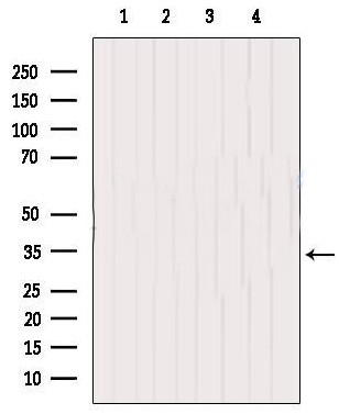CD274 Antibody