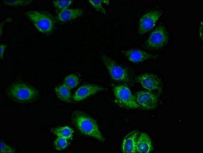 QDPR Antibody