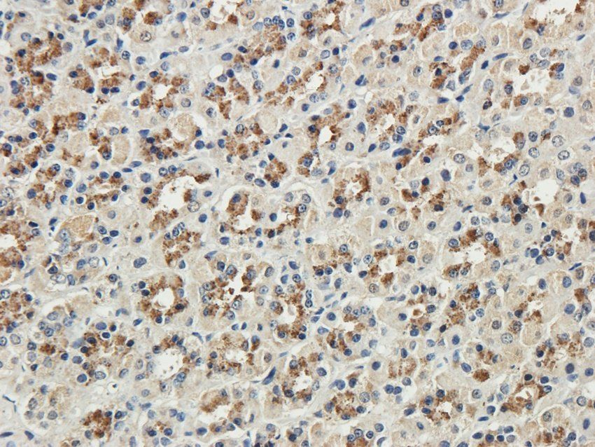 RAB21 Rabbit Polyclonal Antibody