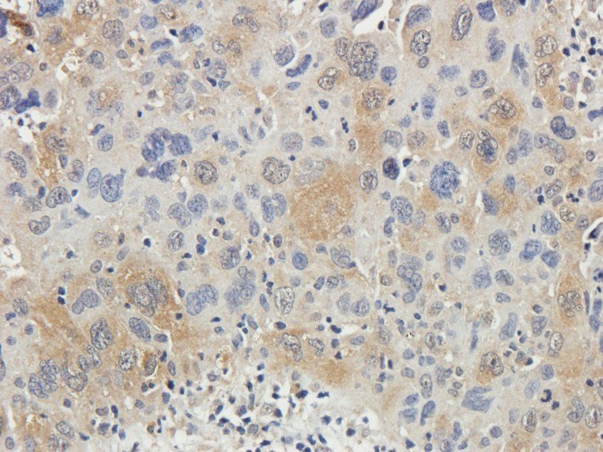 RAB21 Rabbit Polyclonal Antibody