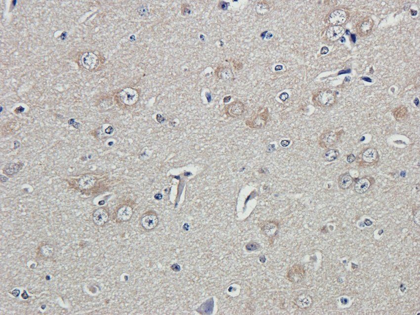 RAB21 Rabbit Polyclonal Antibody