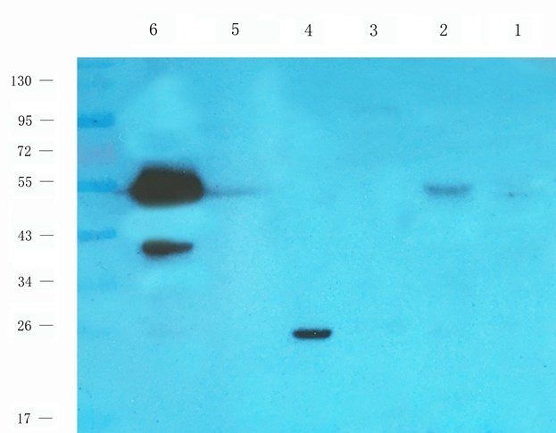 RAB21 Rabbit Polyclonal Antibody