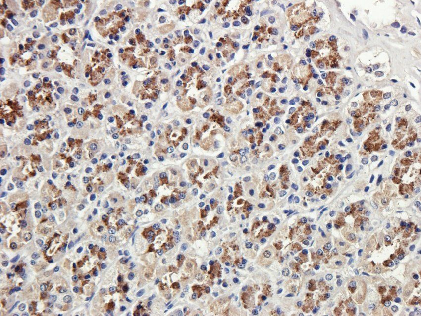 RAB21 Rabbit Polyclonal Antibody