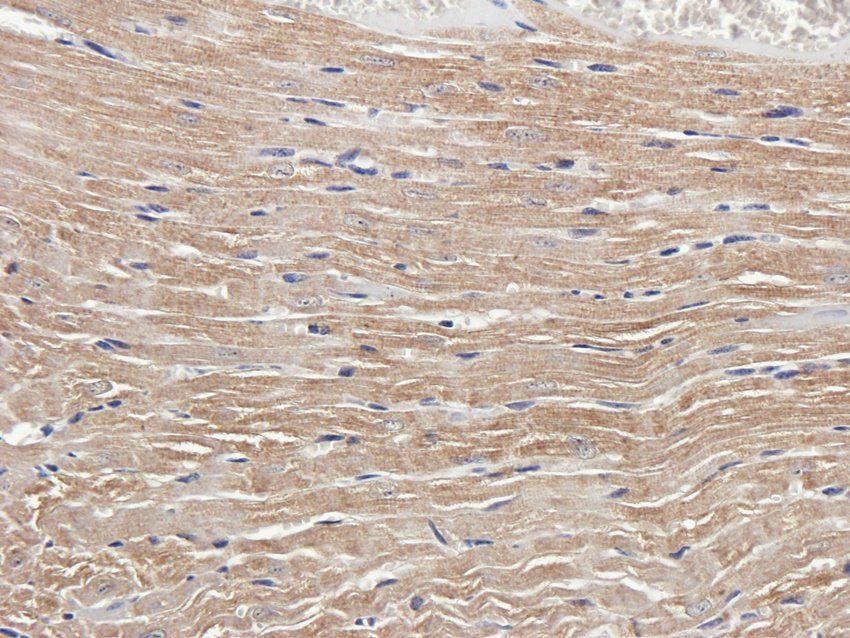 RAB21 Rabbit Polyclonal Antibody