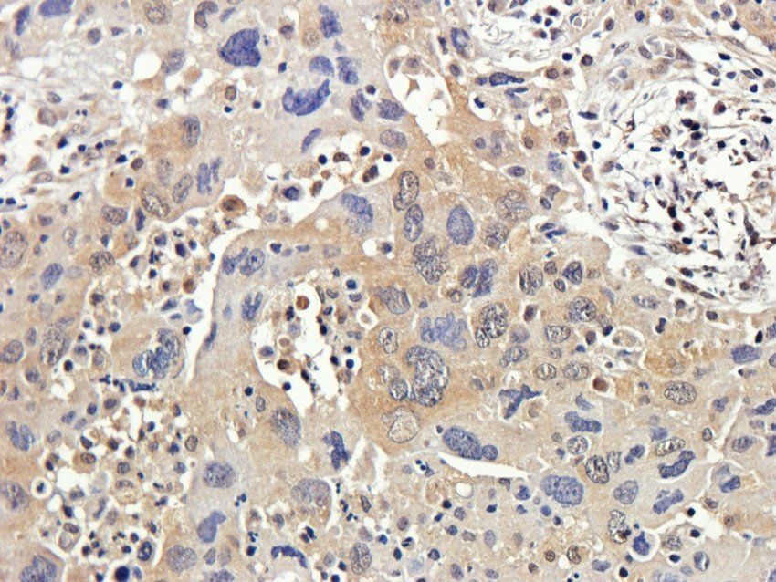 RAB21 Rabbit Polyclonal Antibody