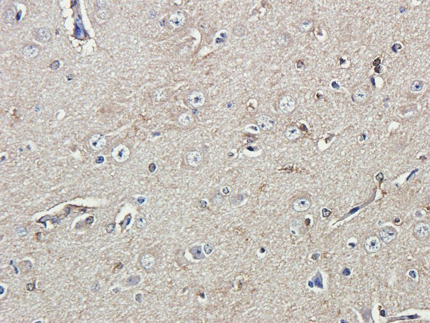 RAB21 Rabbit Polyclonal Antibody