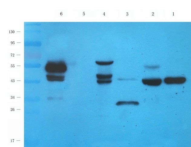 RAB21 Rabbit Polyclonal Antibody