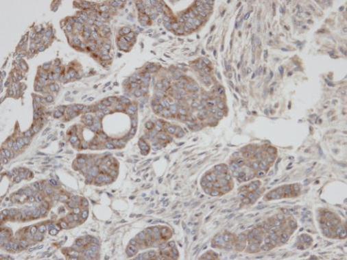 RAB2A, member RAS oncogene family Antibody